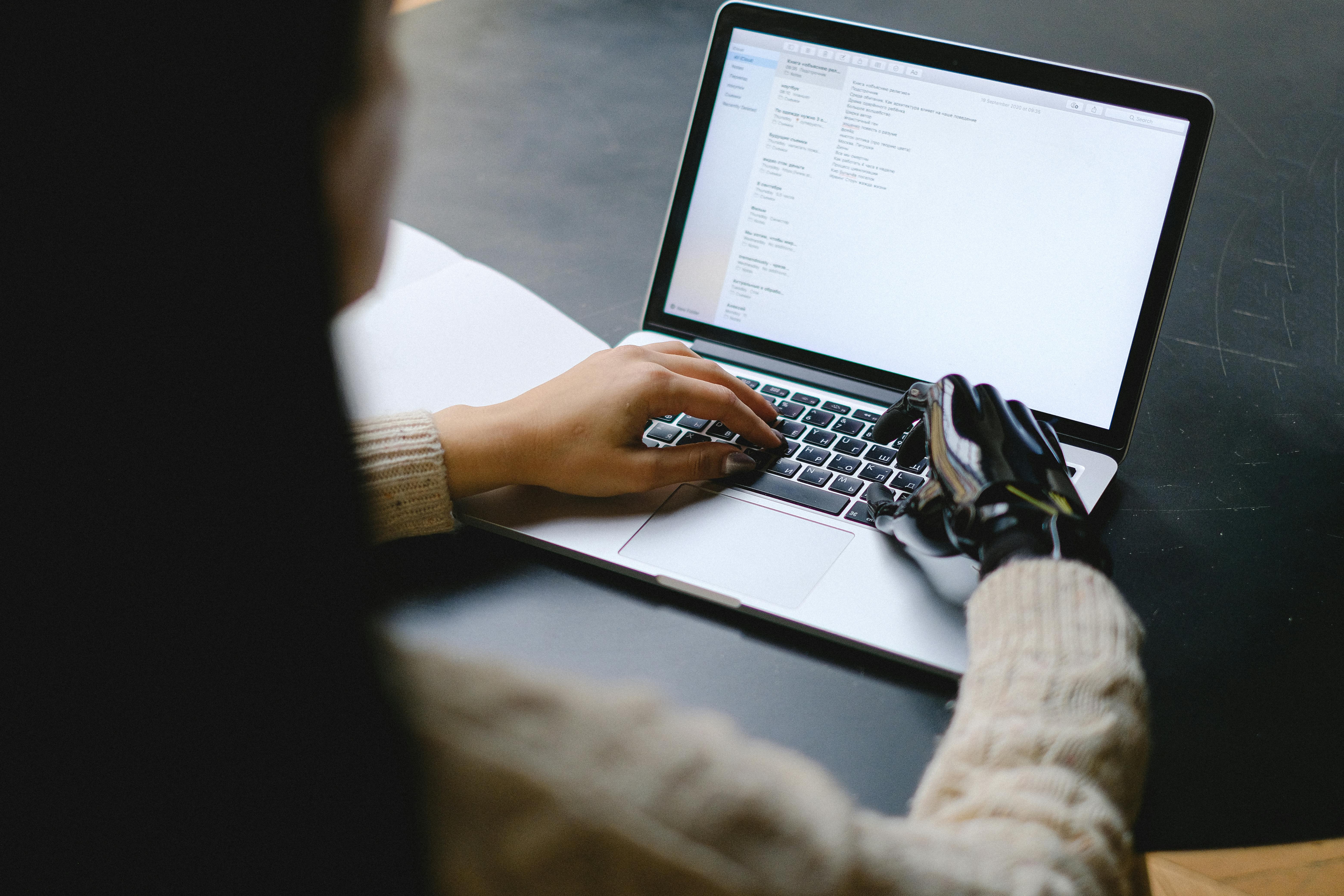 Woman with artificial hand typing and doing work on her laptop 