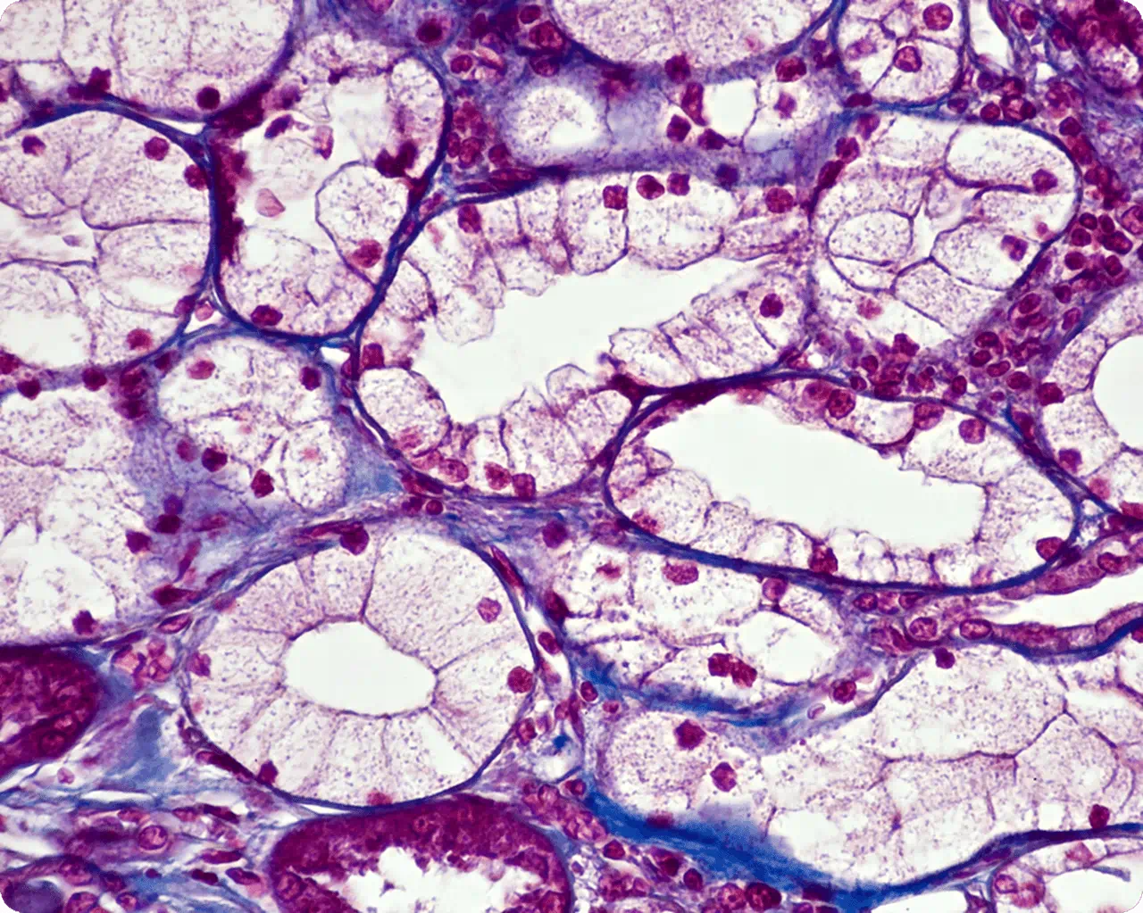 Spotlight on the World’s Most Influential Projects in 2024: 3D Kidney Printing